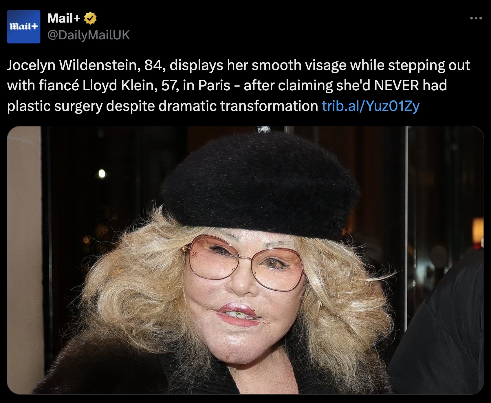 girl - B Mail Mail Jocelyn Wildenstein, 84, displays her smooth visage while stepping out with fianc Lloyd Klein, 57, in Paris after claiming she'd Never had plastic surgery despite dramatic transformation trib.alYuz01Zy